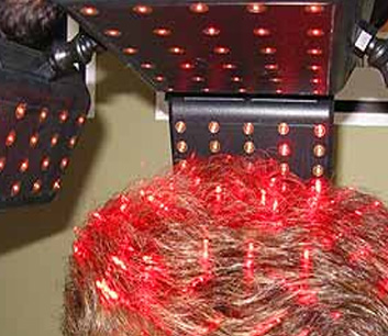 Laser Helmet for Hair Loss