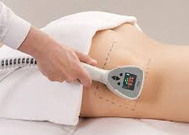 Fat Reduction Treatment in Delhi, Exilis