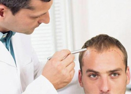 Hair Transplant clinic in Delhi   