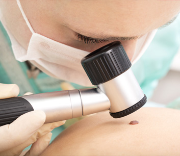 Dermatoscopy in delhi