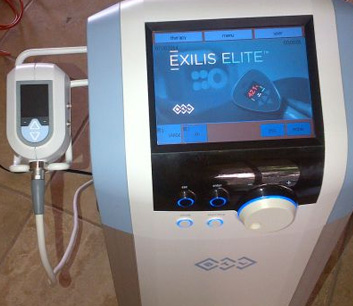 Fat Reduction Treatment in Delhi, Exilis