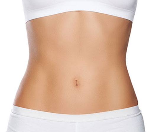 tummy tuck